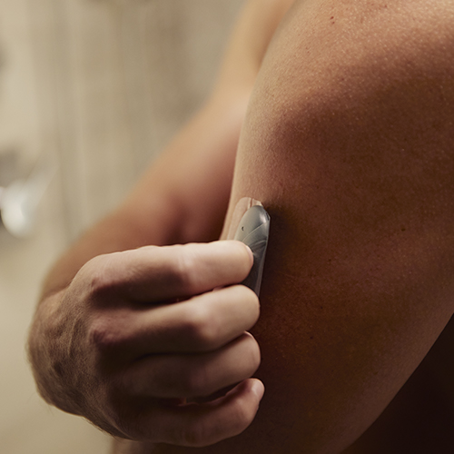 Hombre retirando el monitor de glucosa del brazo con un transmisor de MCG.